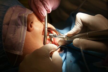 Oralna kirurgija Crnojević Dental Studio